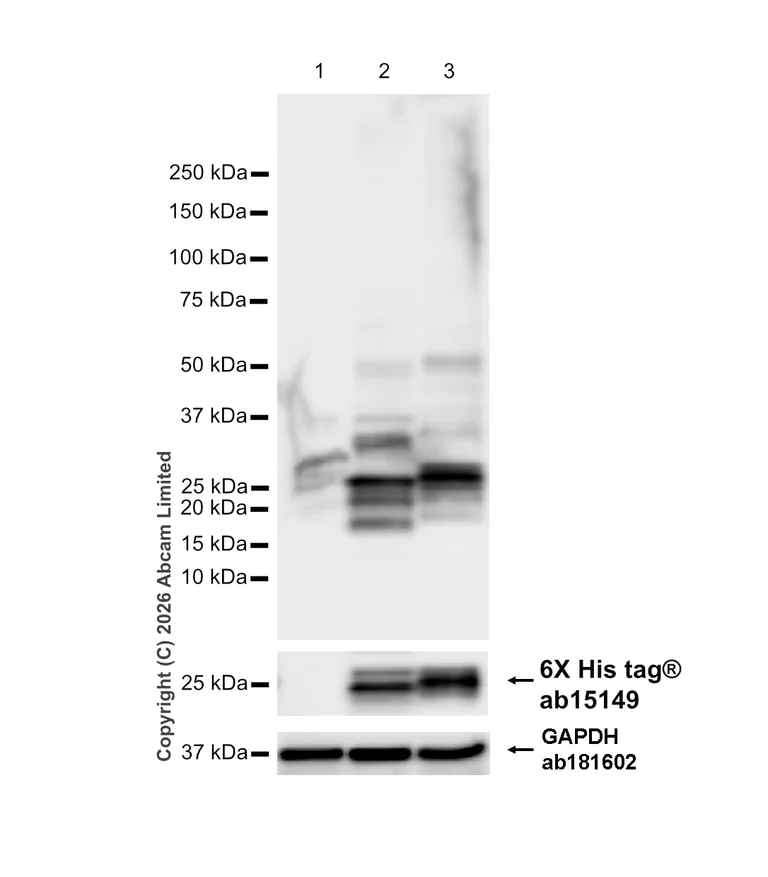 Western blot - Anti-Prosurfactant Protein C antibody [RM1264] (AB322443)