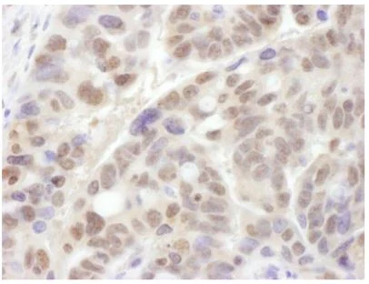 Immunohistochemistry (Formalin/PFA-fixed paraffin-embedded sections) - Anti-Proteasome 19S S4/PSMC1 antibody (AB140450)