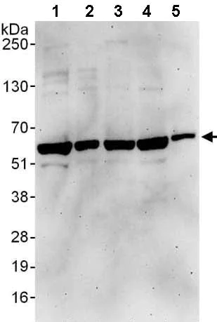 Western blot - Anti-Proteasome 19S S4/PSMC1 antibody (AB140450)