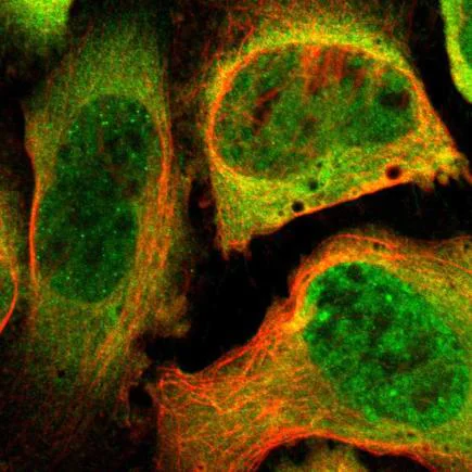 Immunocytochemistry/ Immunofluorescence - Anti-Proteasome 19S S4/PSMC1 antibody (AB223765)