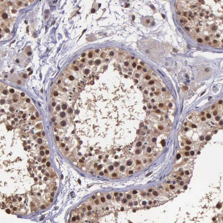 Immunohistochemistry (Formalin/PFA-fixed paraffin-embedded sections) - Anti-Proteasome 19S S4/PSMC1 antibody (AB223765)