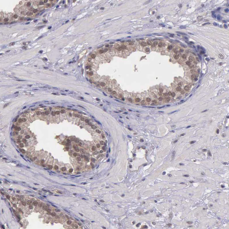 Immunohistochemistry (Formalin/PFA-fixed paraffin-embedded sections) - Anti-Proteasome 19S S4/PSMC1 antibody (AB223765)