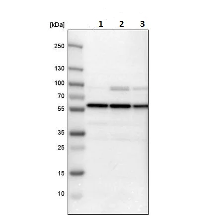 Western blot - Anti-Proteasome 19S S4/PSMC1 antibody (AB223765)
