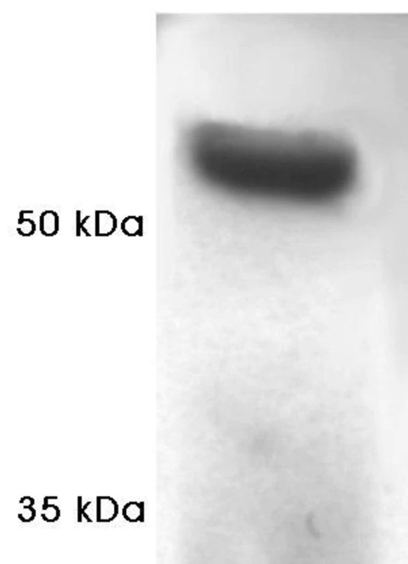 Western blot - Anti-Proteasome 19S S4/PSMC1 antibody (AB3317)