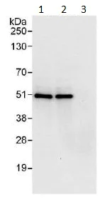 Immunoprecipitation - Anti-Proteasome 19S S5A/ASF antibody (AB140689)