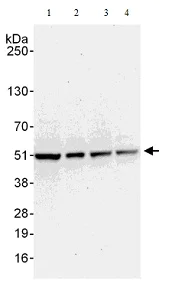 Western blot - Anti-Proteasome 19S S5A/ASF antibody (AB140689)