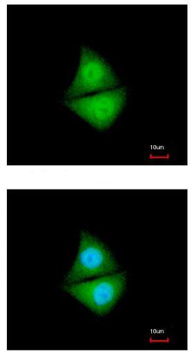 Immunocytochemistry/ Immunofluorescence - Anti-Proteasome 19S S5A/ASF antibody (AB154935)