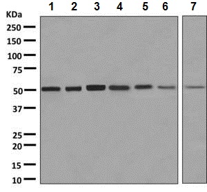 Western blot - Anti-Proteasome 19S S5A/ASF antibody [EPR8936] (AB137109), expandable thumbnail