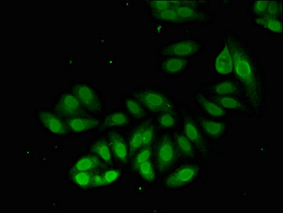 Immunocytochemistry/ Immunofluorescence - Anti-Proteasome 20S alpha 2/HC3 antibody (AB239017)