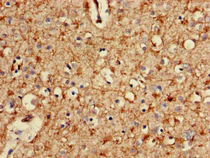 Immunohistochemistry (Formalin/PFA-fixed paraffin-embedded sections) - Anti-Proteasome 20S alpha 2/HC3 antibody (AB239017)
