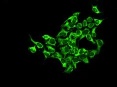 Immunocytochemistry/ Immunofluorescence - Anti-Proteasome 20S alpha 2/HC3 antibody [EPR5453] (AB109525)
