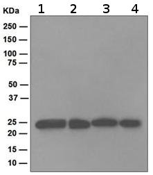 Western blot - Anti-Proteasome 20S alpha 2/HC3 antibody [EPR5453] (AB109525)