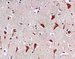 Immunohistochemistry (Formalin/PFA-fixed paraffin-embedded sections) - Anti-Proteasome 20S alpha 2/HC3 antibody [EPR5453] - BSA and Azide free (AB247892)