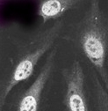 Immunocytochemistry/ Immunofluorescence - Anti-Proteasome 20S alpha 5/PSMA5 antibody (AB11437), expandable thumbnail