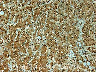 Immunohistochemistry (Formalin/PFA-fixed paraffin-embedded sections) - Anti-Proteasome 20S alpha 5/PSMA5 antibody (AB11437)