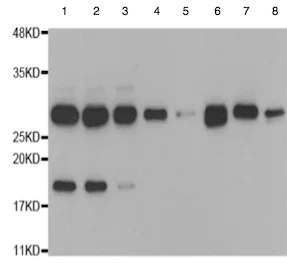Western blot - Anti-Proteasome 20S alpha 5/PSMA5 antibody (AB189855)