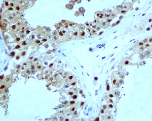 Immunohistochemistry (Formalin/PFA-fixed paraffin-embedded sections) - Anti-Proteasome 20S alpha 5/PSMA5 antibody [EPR5832] (AB109387)