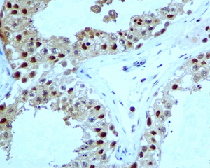 Immunohistochemistry (Formalin/PFA-fixed paraffin-embedded sections) - Anti-Proteasome 20S alpha 5/PSMA5 antibody [EPR5832] - BSA and Azide free (AB247843), expandable thumbnail