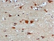 Immunohistochemistry (Formalin/PFA-fixed paraffin-embedded sections) - Anti-Proteasome 20S alpha 5/PSMA5 antibody [EPR5833] (AB109533)