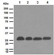 Anti-Proteasome 20S alpha 5/PSMA5 antibody [EPR5833] - BSA