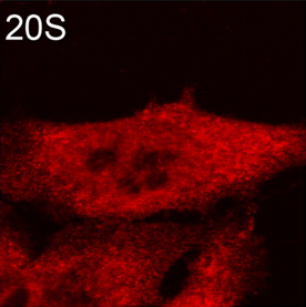 Immunocytochemistry/ Immunofluorescence - Anti-Proteasome 20S alpha + beta antibody (AB22673), expandable thumbnail