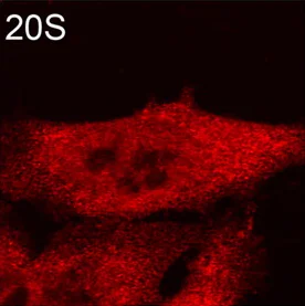 Immunocytochemistry/ Immunofluorescence - Anti-Proteasome 20S alpha + beta antibody (AB22673)