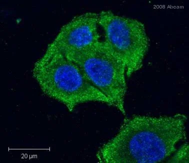 Immunocytochemistry/ Immunofluorescence - Anti-Proteasome 20S alpha + beta antibody (AB22673)