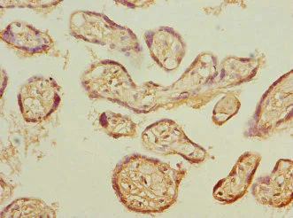 Immunohistochemistry (Formalin/PFA-fixed paraffin-embedded sections) - Anti-Proteasome 20S beta 3 antibody (AB230024)