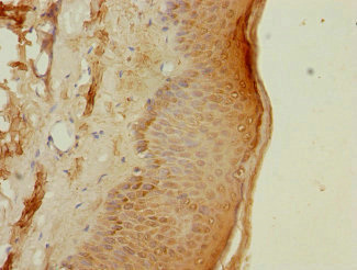 Immunohistochemistry (Formalin/PFA-fixed paraffin-embedded sections) - Anti-Proteasome 20S beta 3 antibody (AB230024)
