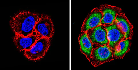 Immunocytochemistry/ Immunofluorescence - Anti-Proteasome 20S beta 6 antibody (AB3331)
