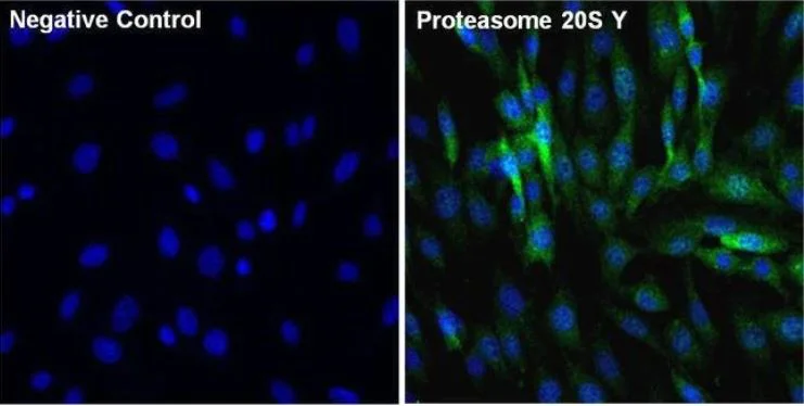Immunocytochemistry/ Immunofluorescence - Anti-Proteasome 20S beta 6 antibody (AB3331)