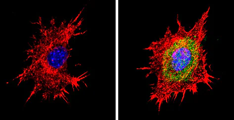Immunocytochemistry/ Immunofluorescence - Anti-Proteasome 20S beta 6 antibody (AB3331)