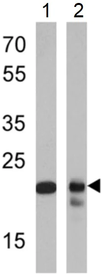 Western blot - Anti-Proteasome 20S beta 6 antibody (AB3331)