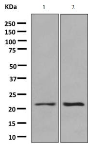 Western blot - Anti-Proteasome 20S beta 6 antibody [EPR9685] (AB150366), expandable thumbnail