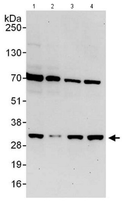 Western blot - Anti-Proteasome 20S C2/HC2 antibody (AB140499), expandable thumbnail
