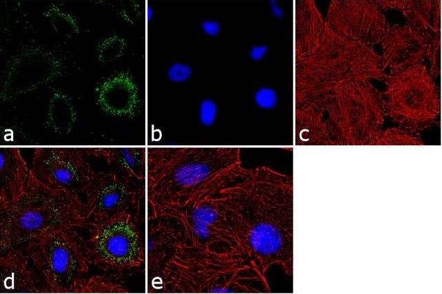 Immunocytochemistry/ Immunofluorescence - Anti-Proteasome 20S C2/HC2 antibody (AB3325)