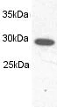 Western blot - Anti-Proteasome 20S C2/HC2 antibody (AB3325)