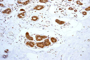 Immunohistochemistry (Formalin/PFA-fixed paraffin-embedded sections) - Anti-Proteasome 20S C2/HC2 antibody [EPR5451] (AB109500)