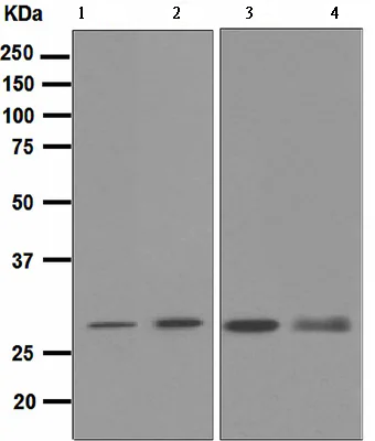 Western blot - Anti-Proteasome 20S C2/HC2 antibody [EPR5451] (AB109500)