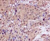 Immunohistochemistry (Formalin/PFA-fixed paraffin-embedded sections) - Anti-Proteasome 20S C2/HC2 antibody [EPR5452] - BSA and Azide free (AB247894), expandable thumbnail