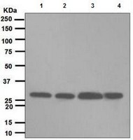 Western blot - Anti-Proteasome 20S C2/HC2 antibody [EPR5452] - BSA and Azide free (AB247894), expandable thumbnail