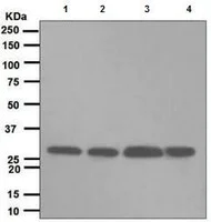 Western blot - Anti-Proteasome 20S C2/HC2 antibody [EPR5452] - BSA and Azide free (AB247894)