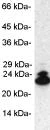 Western blot - Anti-Proteasome 20S LMP2 antibody (AB3328)