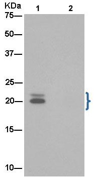 Immunoprecipitation - Anti-Proteasome 20S LMP2 antibody [EPR13784] (AB187645), expandable thumbnail
