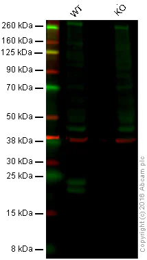 Western blot - Anti-Proteasome 20S LMP2 antibody [EPR13784] (AB187645)