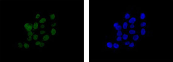 Immunocytochemistry/ Immunofluorescence - Anti-Proteasome 20S LMP2 antibody [EPR13784] - BSA and Azide free (AB250928)