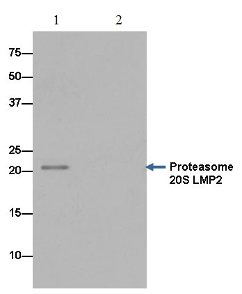 Immunoprecipitation - Anti-Proteasome 20S LMP2 antibody [EPR13785] (AB184172)