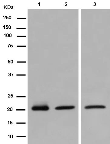 Western blot - Anti-Proteasome 20S LMP2 antibody [EPR13785] (AB184172)