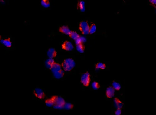 Immunocytochemistry/ Immunofluorescence - Anti-Proteasome 20S LMP2 antibody [EPR13785] - BSA and Azide free (AB238435)