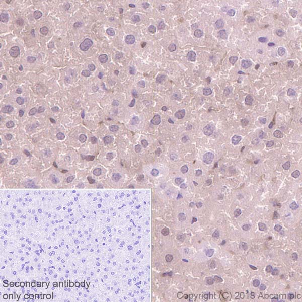 Immunohistochemistry (Formalin/PFA-fixed paraffin-embedded sections) - Anti-Proteasome 20S LMP2 antibody [EPR22042] (ab242061), expandable thumbnail
